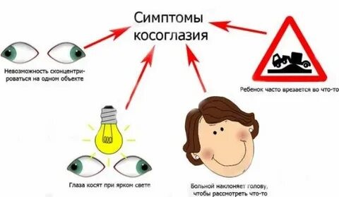 симптомы косоглазия.jpg симптомы косоглазия
