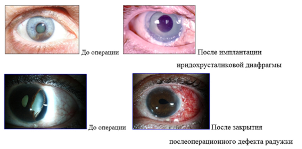 Комбинированные методики