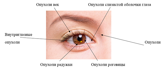 Лечение опухоли глаза