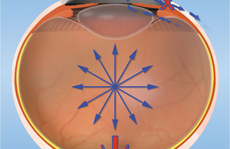 Photoц45345354.png Photoц45345354.png